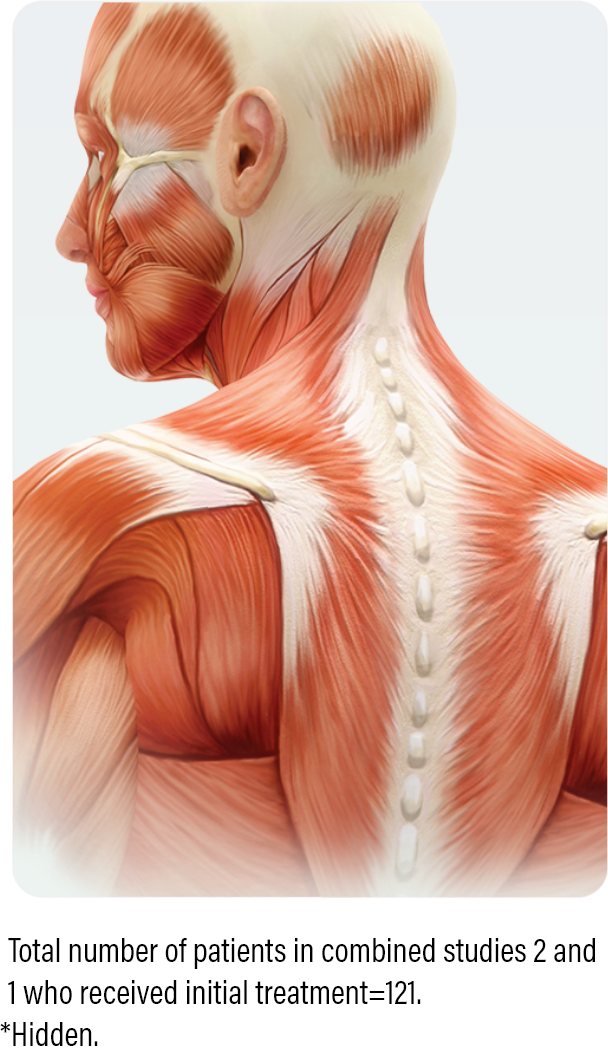 medical diagram wshowing how to dose and administer dysport to patients with cervical dystonia