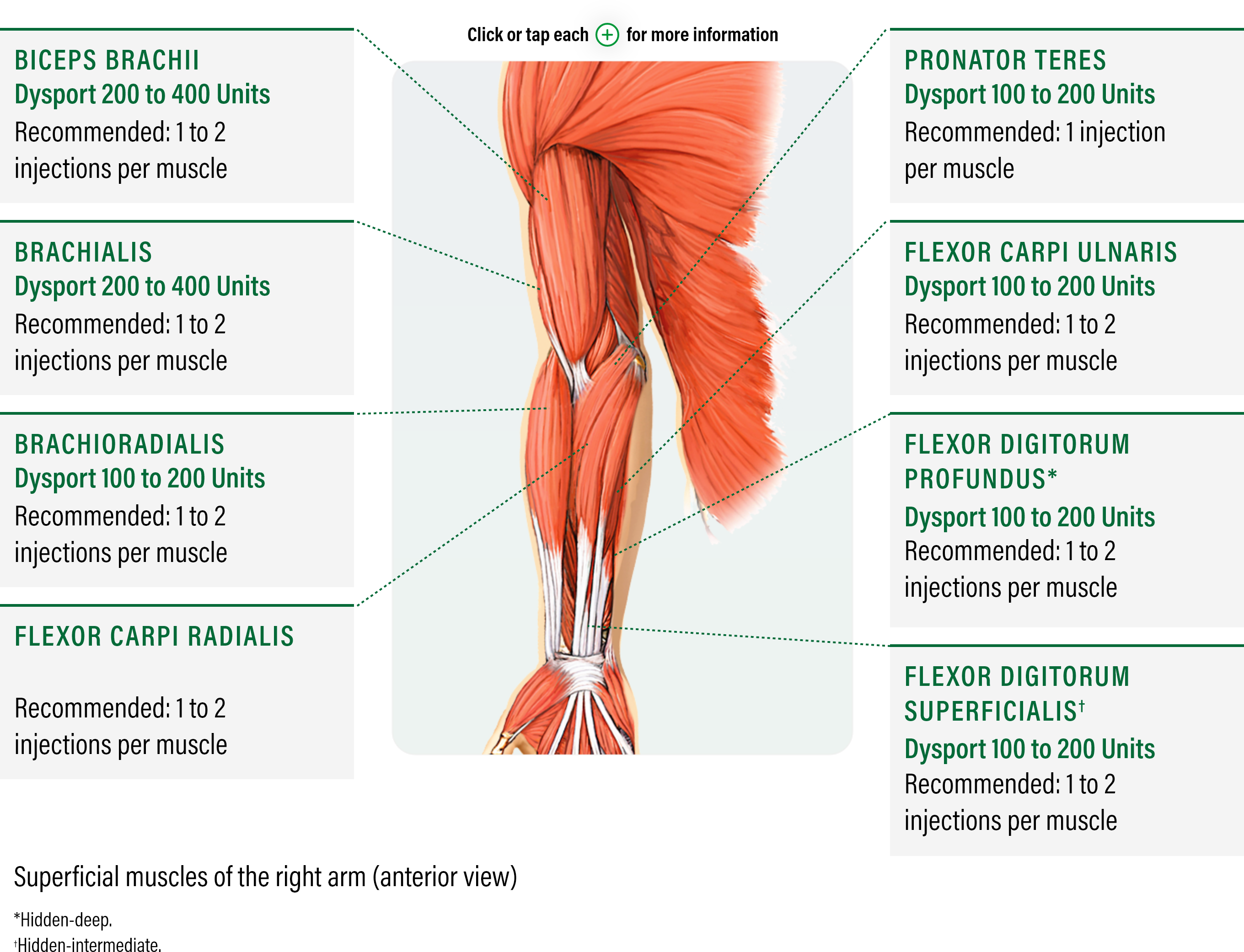 medical diagram with an anterior view showing how to dose and administer dysport for superficial muscles of the right arm in adults with upper limb spasticity